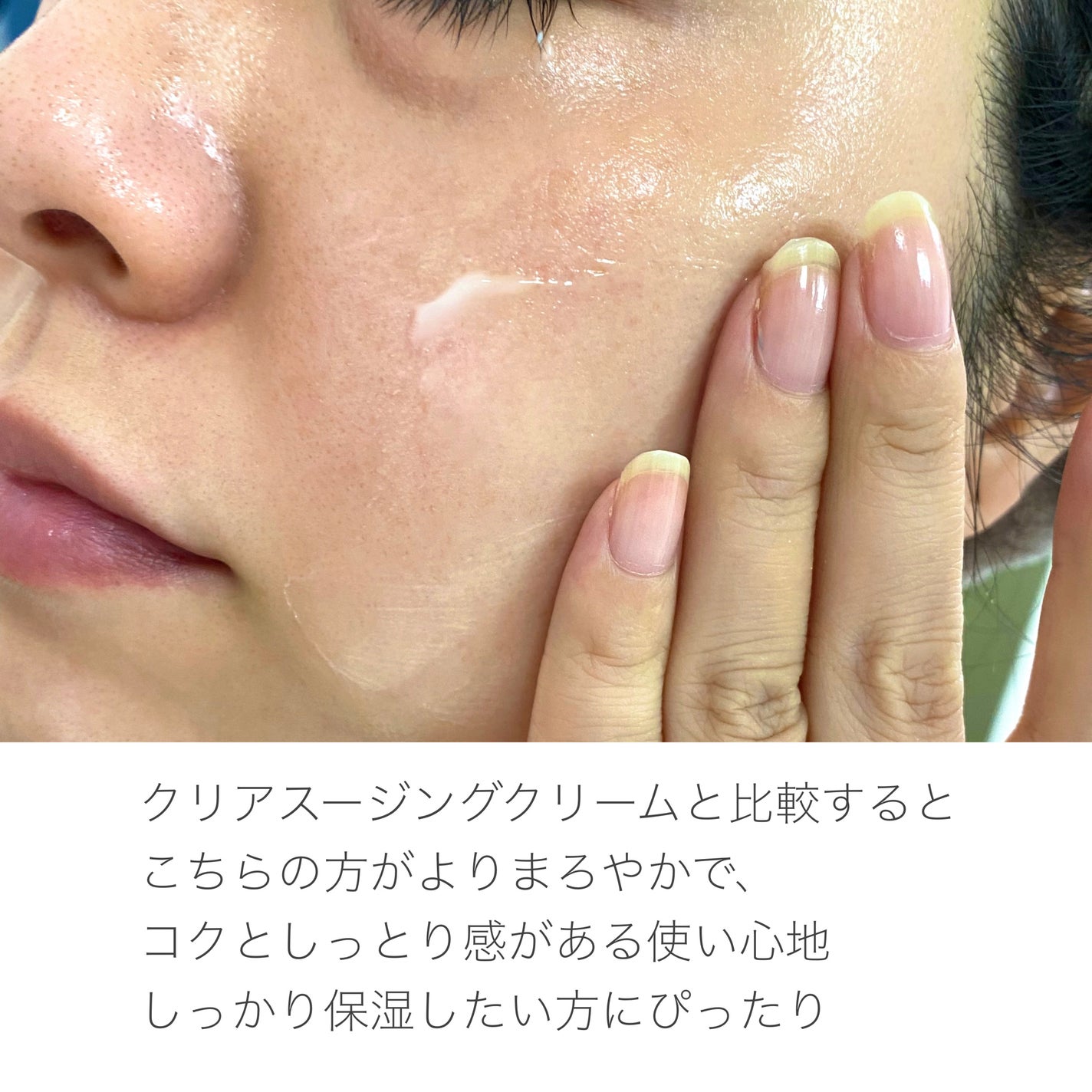 レッドブレミッシュ クリアモイスチャークリーム/Dr.G/フェイスクリームを使ったクチコミ(6枚目)