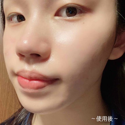 バイオカプセルイン ハイドラドロップマスク/MEDIHEAL/シートマスク・パックを使ったクチコミ(4枚目)