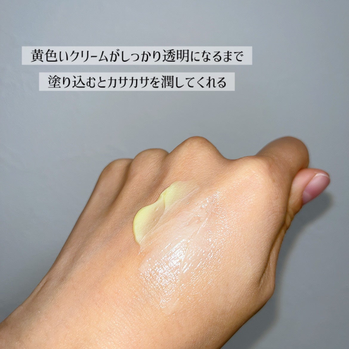 ユースキン/ユースキン/ボディクリームを使ったクチコミ(4枚目)