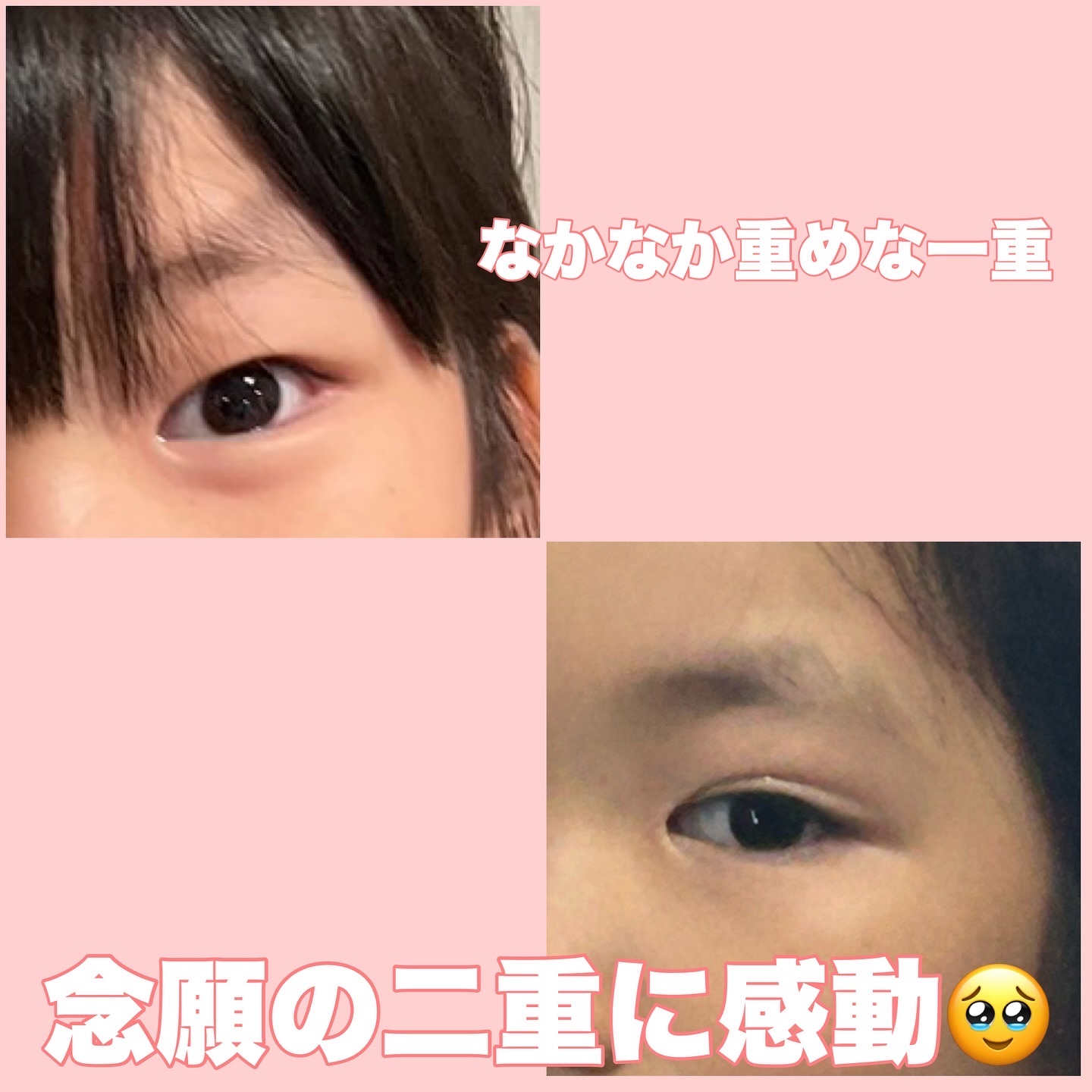 フリーファイバー120<下地&カッター付き>スタンダードタイプ 120本入/メザイク/二重まぶた用アイテムを使ったクチコミ（3枚目）