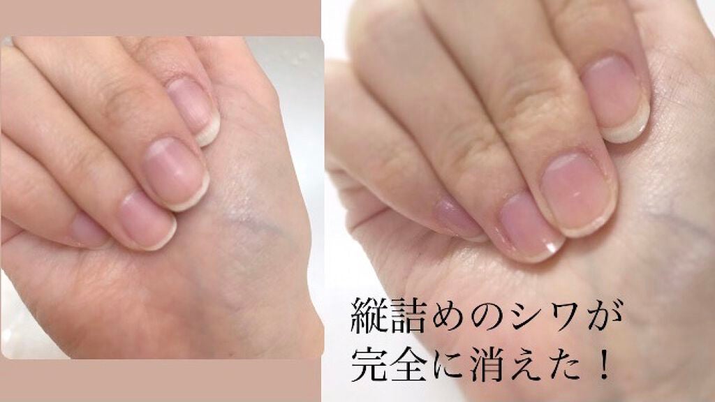 カラフルネイルズ/キャンメイク/マニキュアを使ったクチコミ(2枚目)