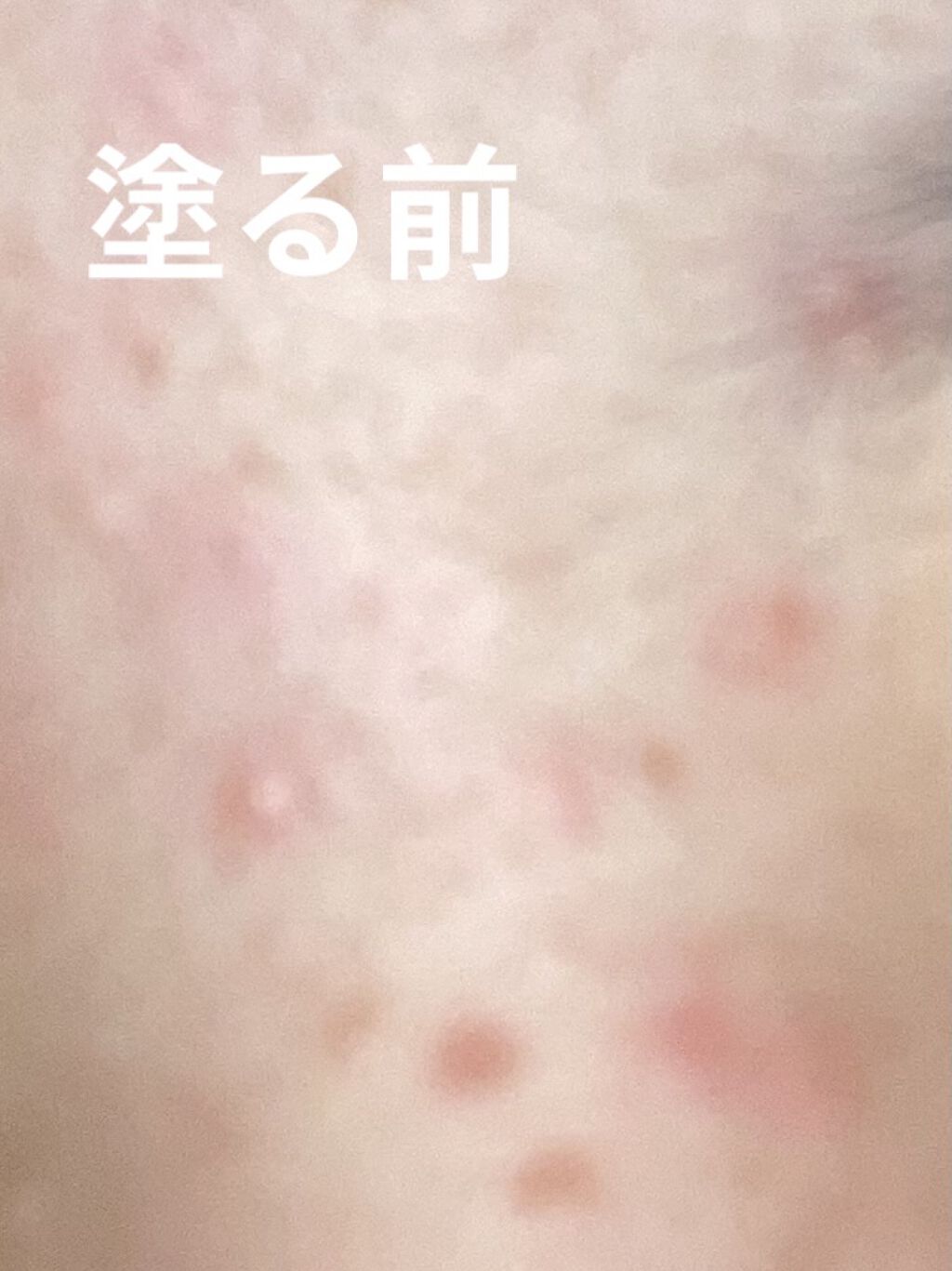 CICA カプセルマスク/VT/洗い流すパック・マスクを使ったクチコミ（3枚目）