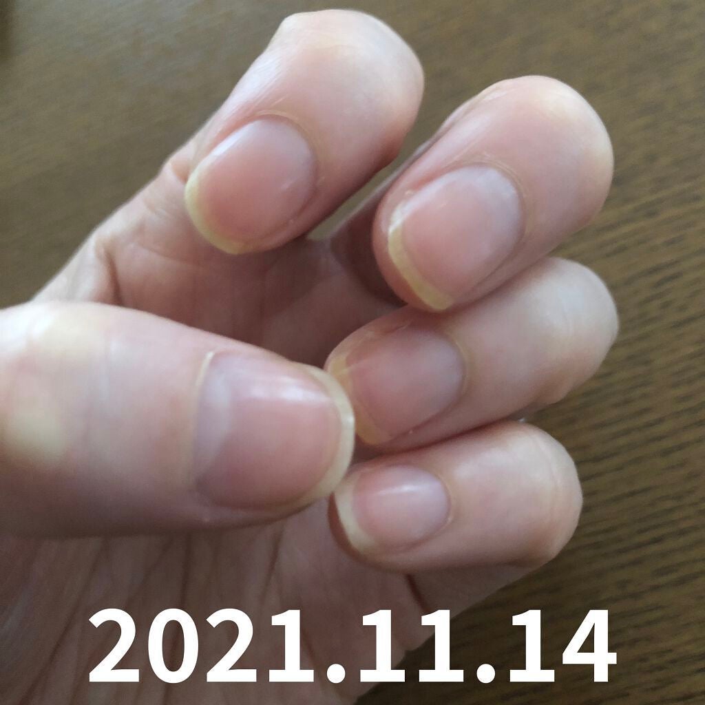 キューティクルオイル/ネイルホリック/ネイルオイル・トリートメントを使ったクチコミ(7枚目)