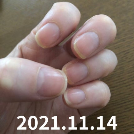 キューティクルオイル/ネイルホリック/ネイルオイル・トリートメントを使ったクチコミ(7枚目)