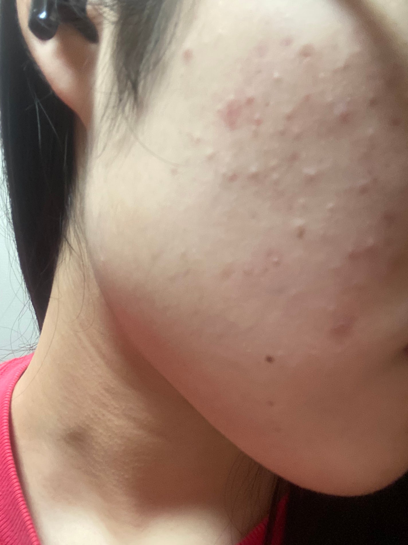 シカレチA エッセンス0.1/VT/美容液を使ったクチコミ(3枚目)