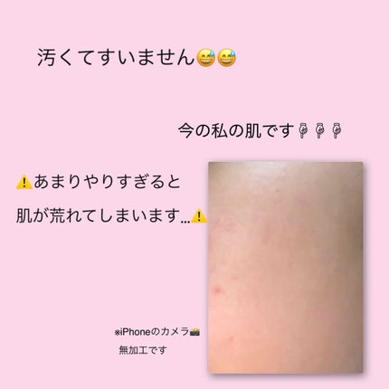 ロゼットゴマージュ モイスト/ロゼット/ピーリングを使ったクチコミ(4枚目)