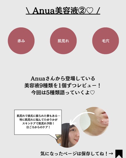ã¬ãããŒã«0.3 ãã€ã¢ã·ã³ãªãã¥ãŒã€ã³ã°ã»ã©ã /Anua/çŸå®¹æ¶²ã䜿ã£ãã¯ãã³ãïŒ2æç®ïŒ