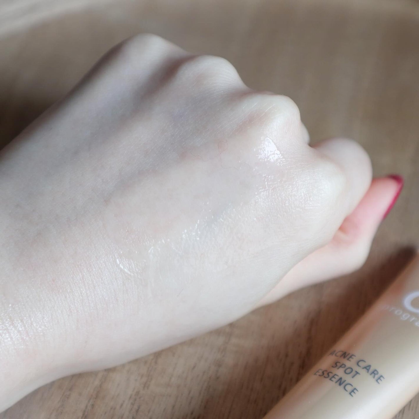 薬用 アクネケア美容液/d プログラム/美容液を使ったクチコミ(3枚目)