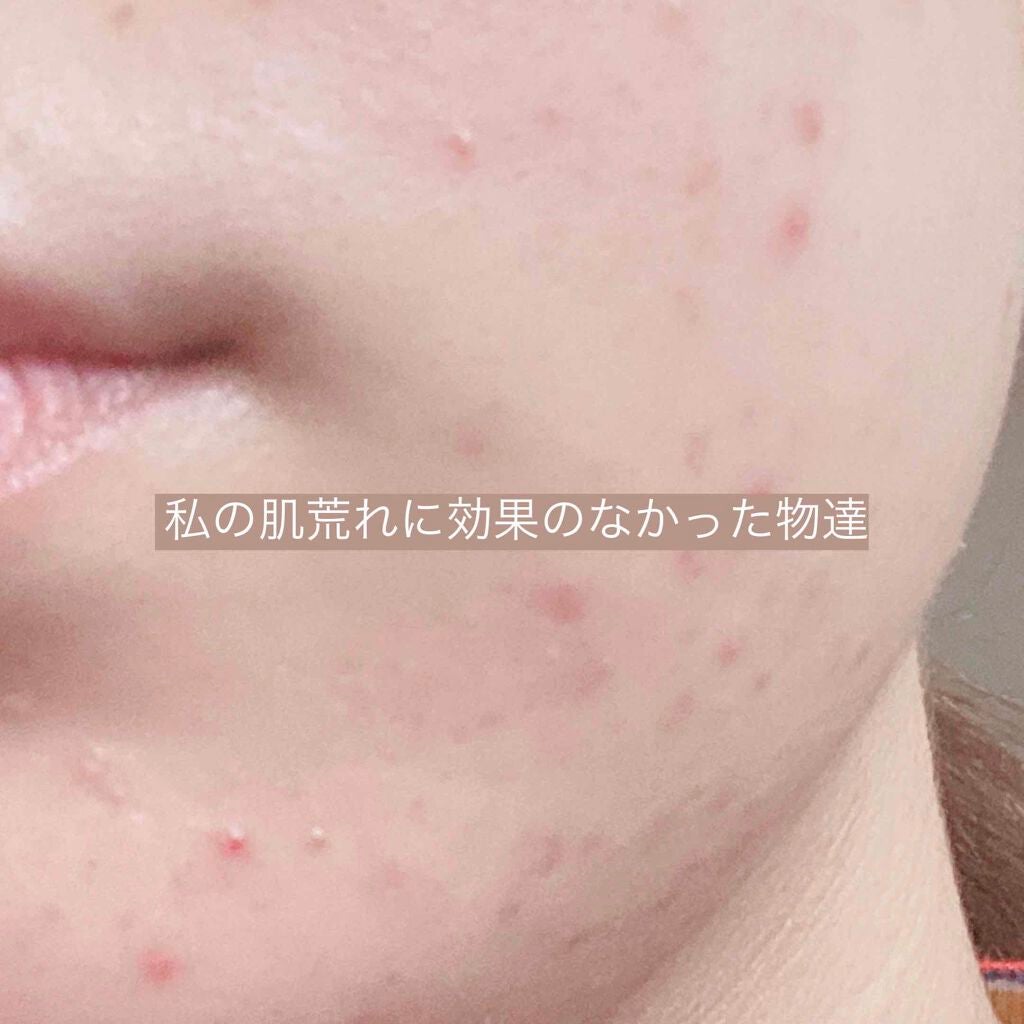 DHC ビタミンBミックス/DHC/美容サプリメントを使ったクチコミ(1枚目)