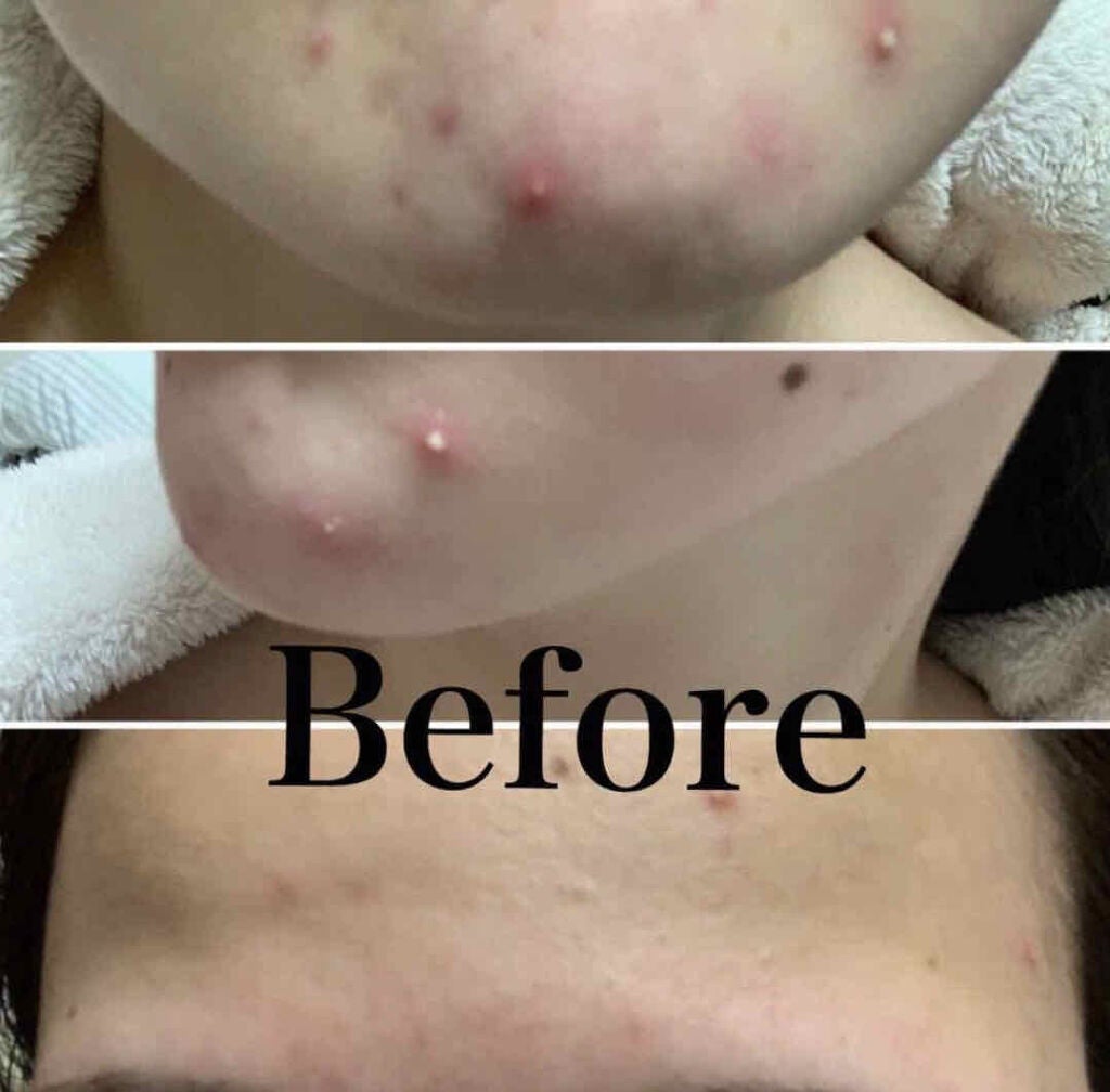 明色美顔水 薬用化粧水/美顔/化粧水を使ったクチコミ(2枚目)