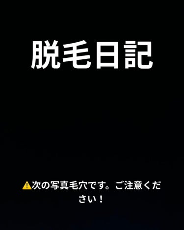 FASIZ607C IPL光脱毛器/FASIZ/家庭用脱毛器を使ったクチコミ（1枚目）