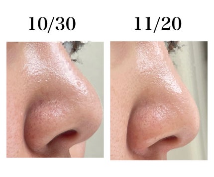 CICA デイリースージングマスク/VT/シートマスク・パックを使ったクチコミ(3枚目)