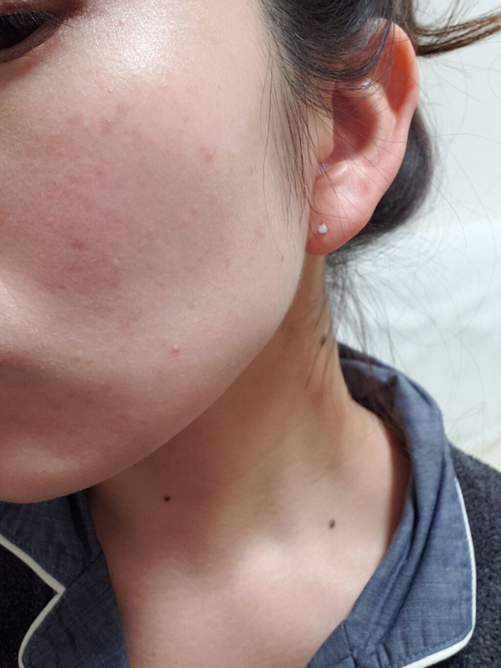 ジョンソン ベビーオイル 無香料/ジョンソンベビー/ボディオイルを使ったクチコミ（1枚目）