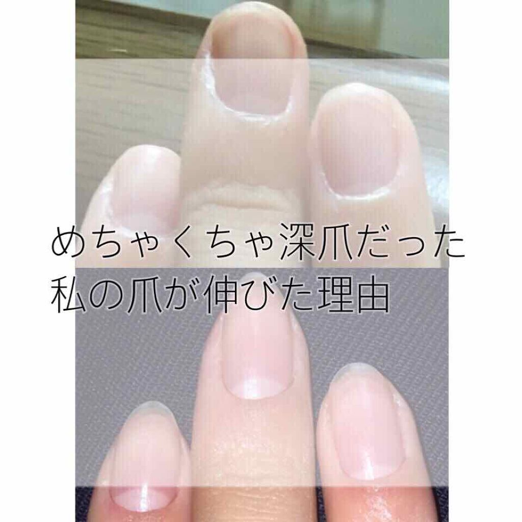 クイックケアコート Ettusaisを使った口コミ 私の爪事情 皆さんはじめまして ゆい By ぷりん 乾燥肌 Lips