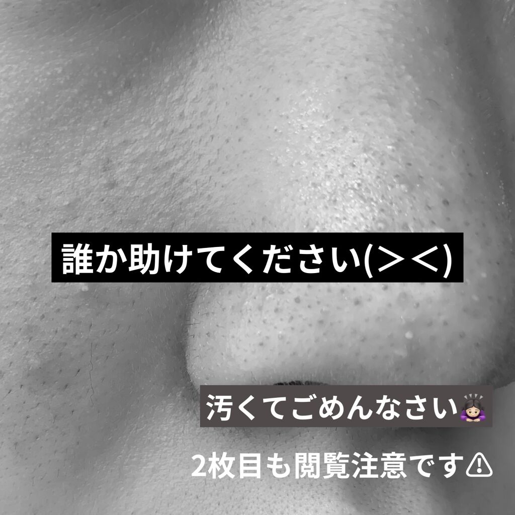 素肌のしずく/アサヒ飲料/化粧水を使ったクチコミ（1枚目）