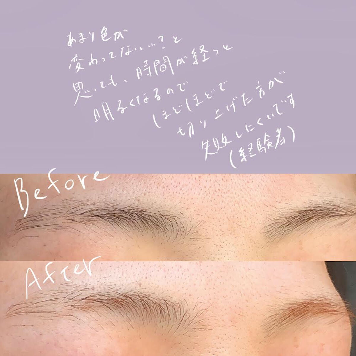 脱色クリーム 敏感肌用/エピラット/ムダ毛ケアを使ったクチコミ(6枚目)