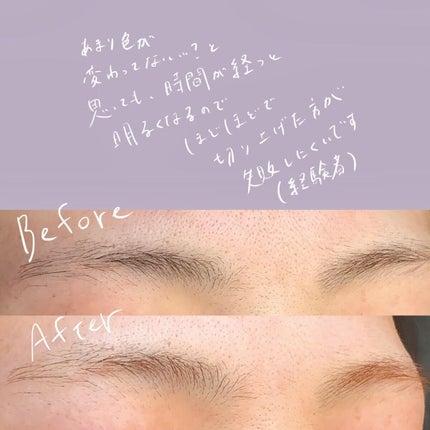 脱色クリーム 敏感肌用/エピラット/ムダ毛ケアを使ったクチコミ(6枚目)