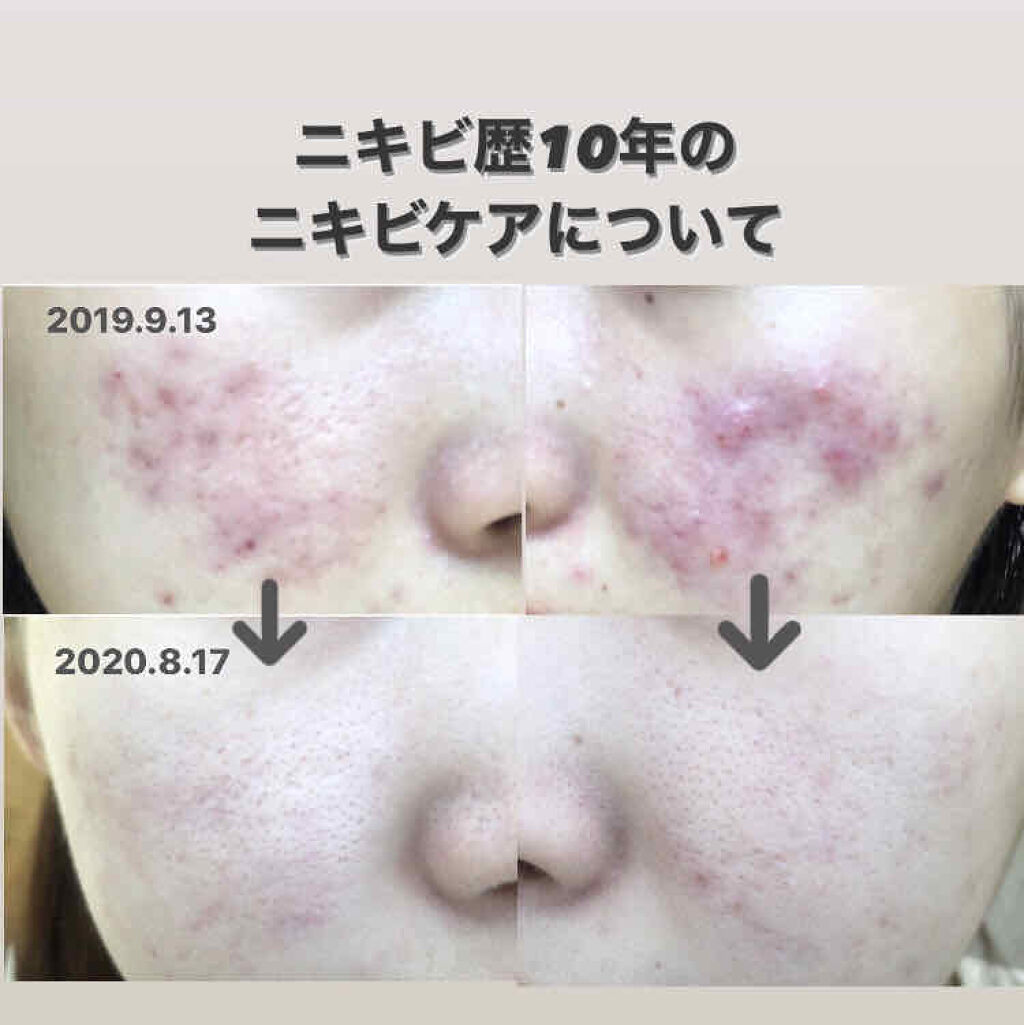 アイメイク方法 スウィートアーモンドオイル 無印良品の使い方 お見苦しい写真すみませ By M A I M U Lips アイメイク方法 スウィートアーモンドオイル 無印良品の使い方 お見苦しい写真すみませ By M A I M U Lips