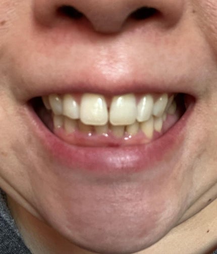 DENTA ONE/シーヴァ/その他を使ったクチコミ(6枚目)