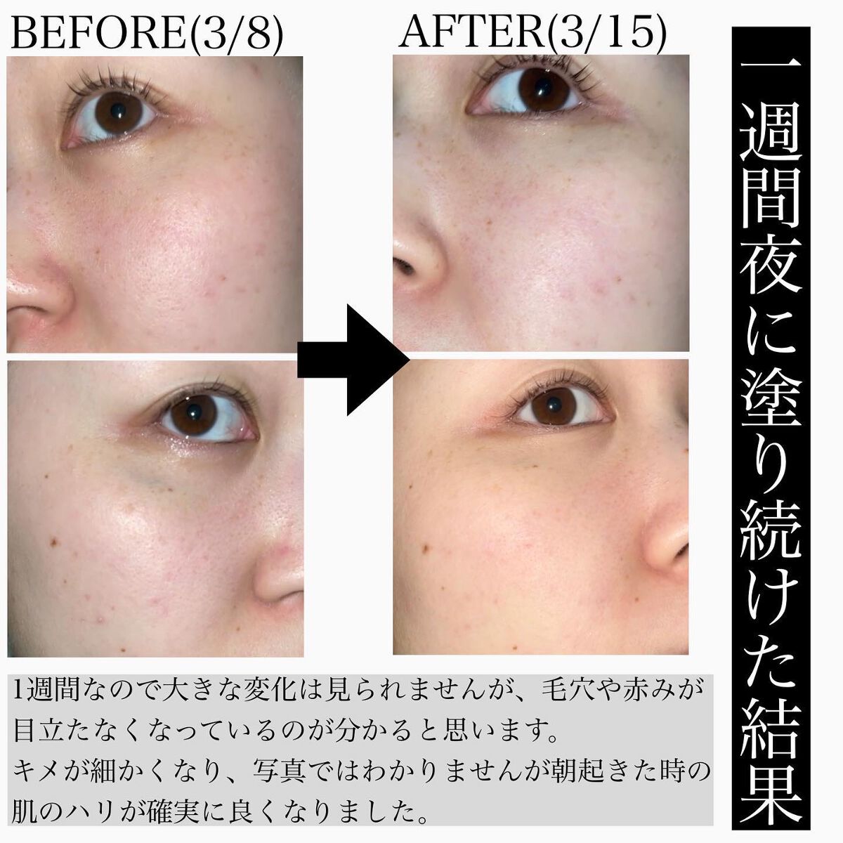 レチノール シカ リペア セラム/innisfree/美容液を使ったクチコミ(2枚目)