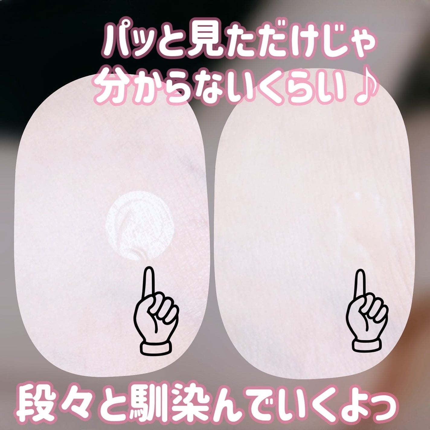 Dr.G Aクリアスポットパッチ/Dr.G/その他スキンケアを使ったクチコミ(4枚目)