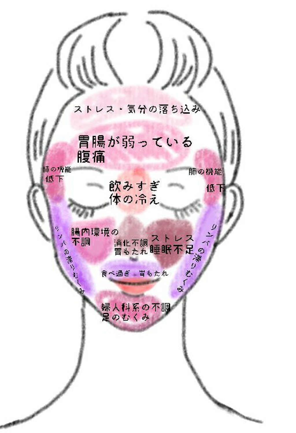 オロナインH軟膏 (医薬品)/オロナイン/その他を使ったクチコミ(2枚目)