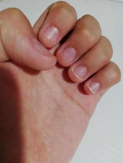 まちゃまちゃ(・ω・) on LIPS 「深爪直そうと思い4日目…。左手の薬指と小指が伸びてきました!で..」(3枚目)