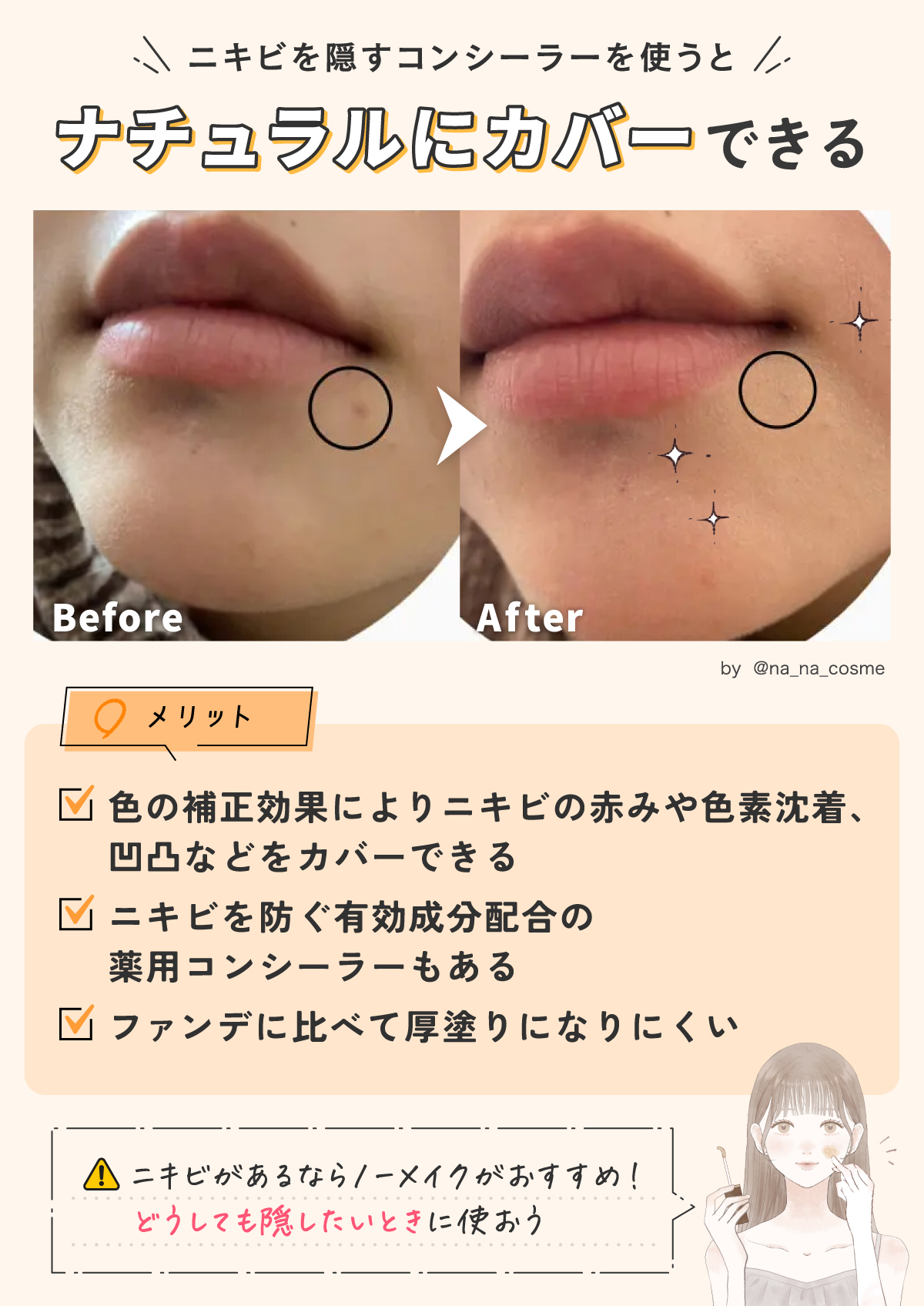 ニキビを隠すコンシーラーを使うとナチュラルにカバーできる。色の補正効果によりニキビの赤みや色素沈着、凹凸などをカバーでき、ファンデに比べて厚塗りになりにくい。ニキビを防ぐ有効成分配合の薬用コンシーラーもあるなどのメリットがあります。ニキビがあるならノーメイクがおすすめ！どうしても隠したいときに使おう。