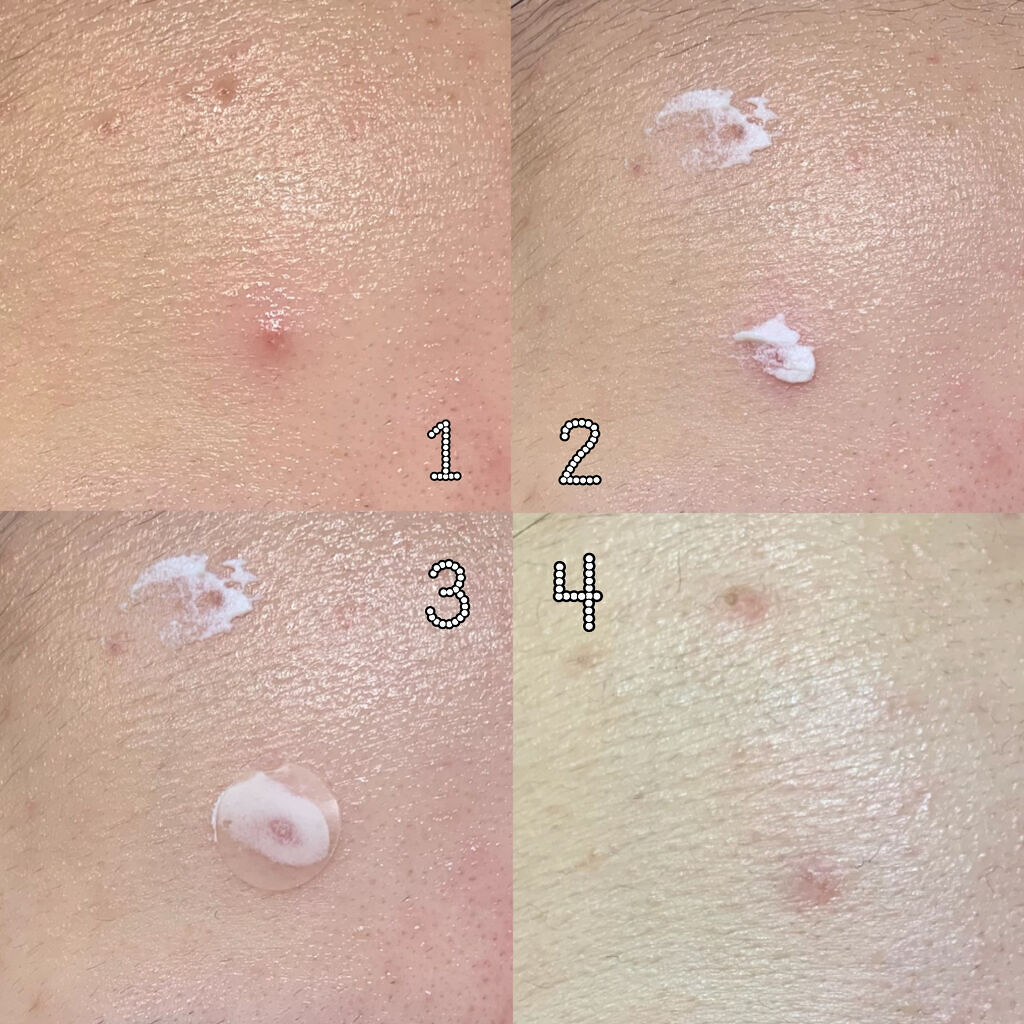 を使ったクチコミ（3枚目）