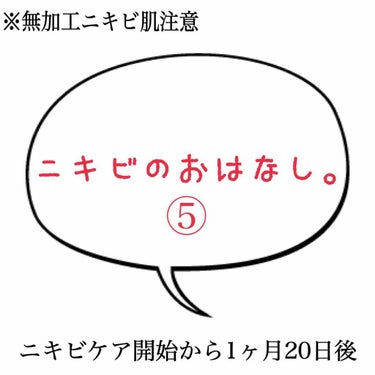 ニキビのおはなし。⑤


こんにちは🙋‍♀️
あけましておめでとうございます。
本年もよろしくお願いします😊

ニキビケアを本格的に始めて1ヶ月と20日経ちました。

ちょいちょい新しいニキビはできます