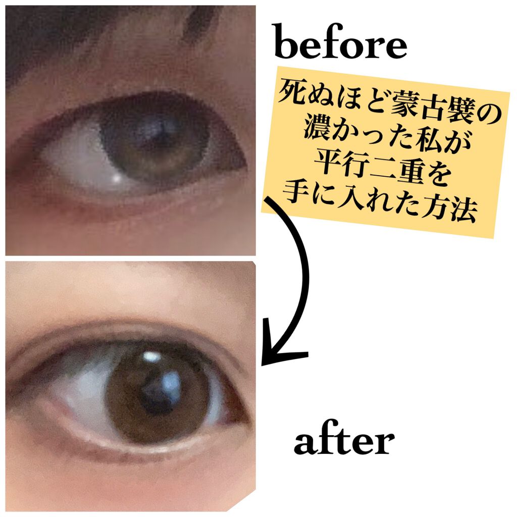 りそうのふたえ くっきりクセづけ/DAISO/二重まぶた用アイテムを使ったクチコミ(1枚目)