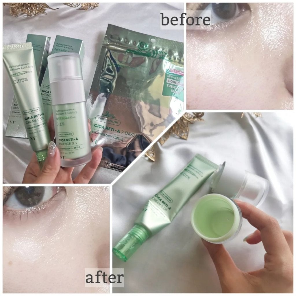 シカレチA エッセンス0.1/VT/美容液を使ったクチコミ(2枚目)