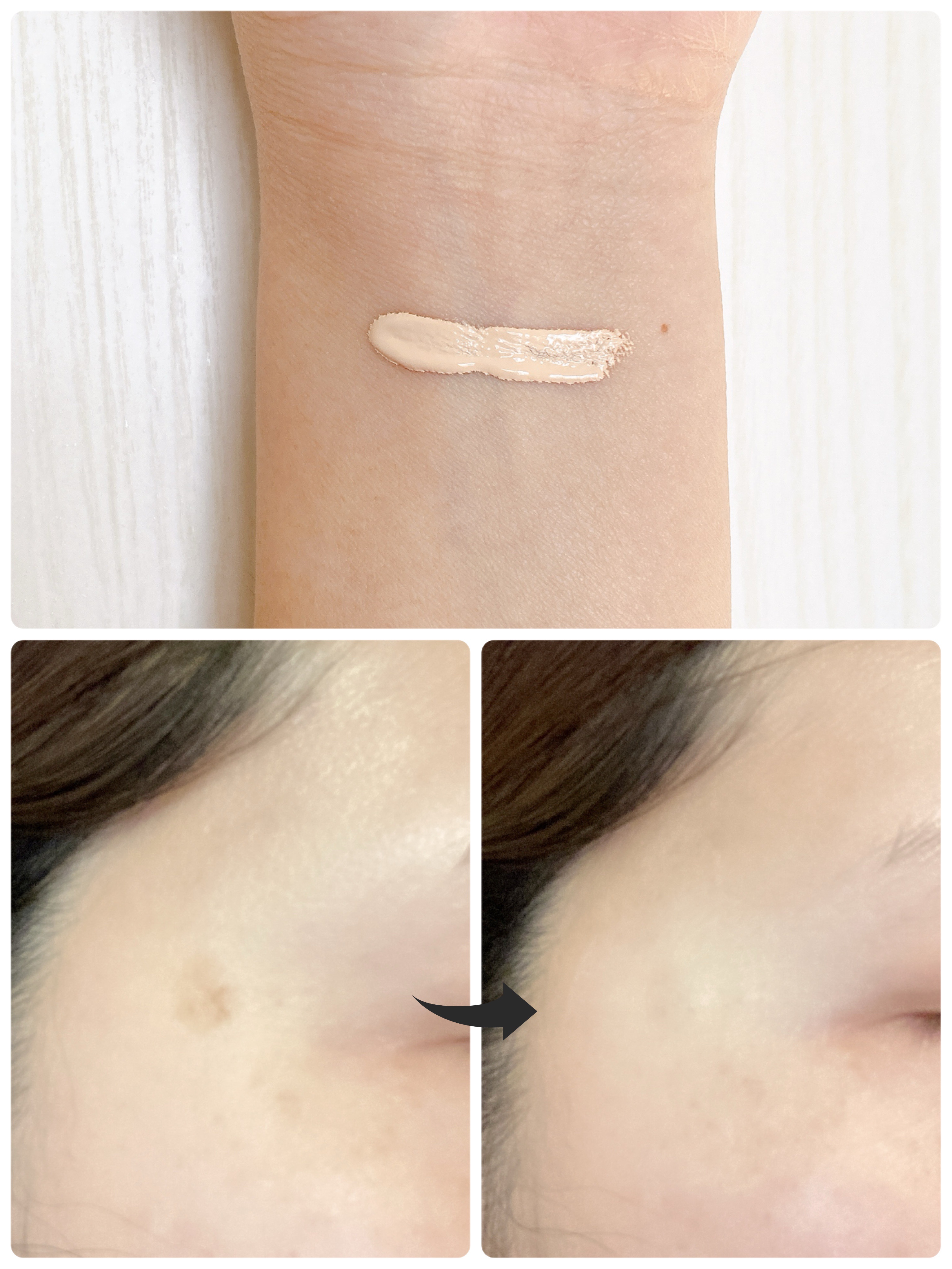 ダーマシンコンシーラー/23years old/リキッドコンシーラーを使ったクチコミ（3枚目）