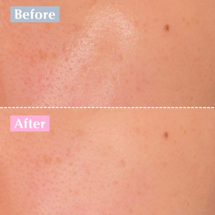 バイオームビタCダークスポットセラム/UIQ/美容液を使ったクチコミ(10枚目)