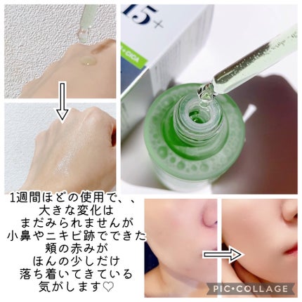 アゼライン酸15 インテンスカーミングセラム/Anua/美容液を使ったクチコミ(4枚目)