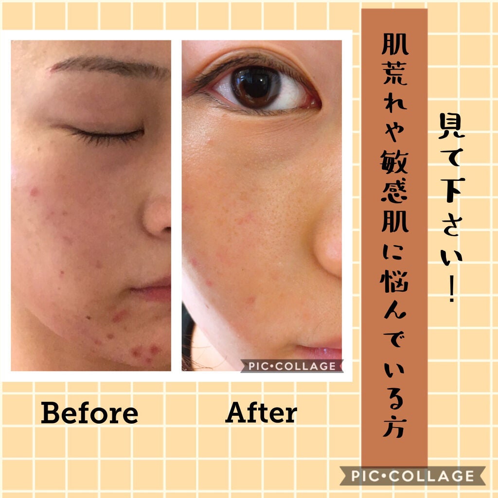 潤浸保湿 泡洗顔料/キュレル/泡洗顔を使ったクチコミ(1枚目)