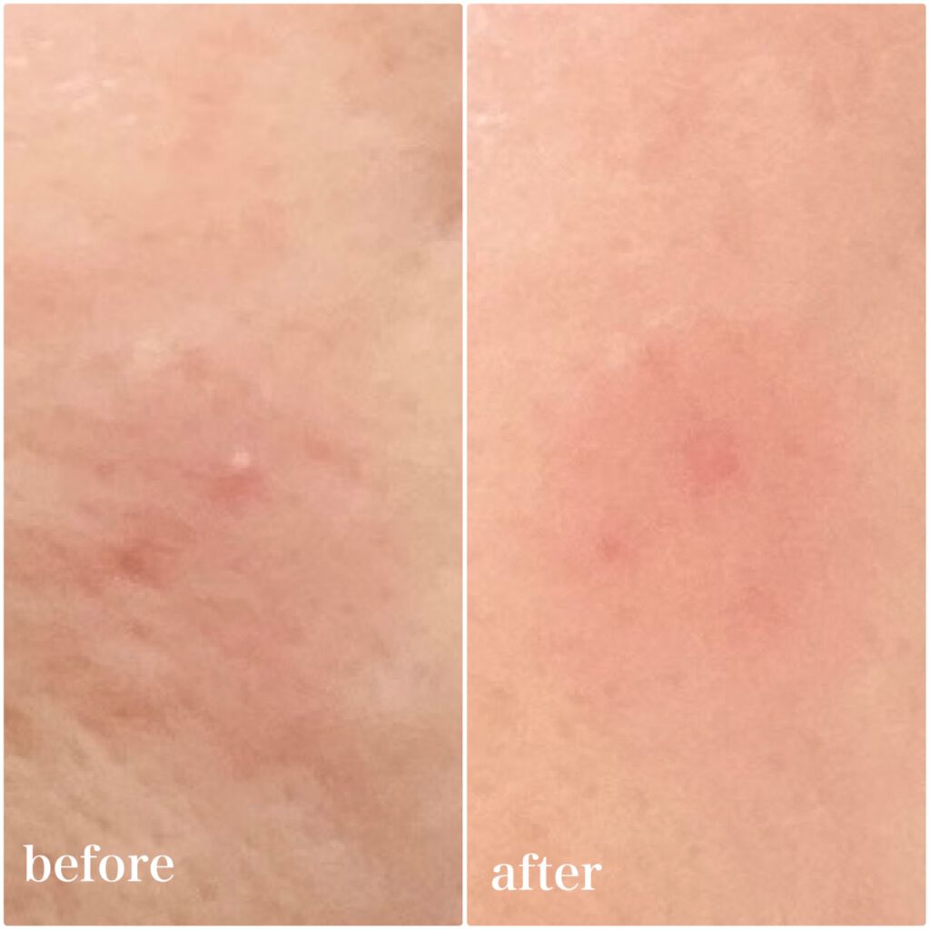 トラブルキュア/美肌ファクトリー/シートマスク・パックを使ったクチコミ(7枚目)