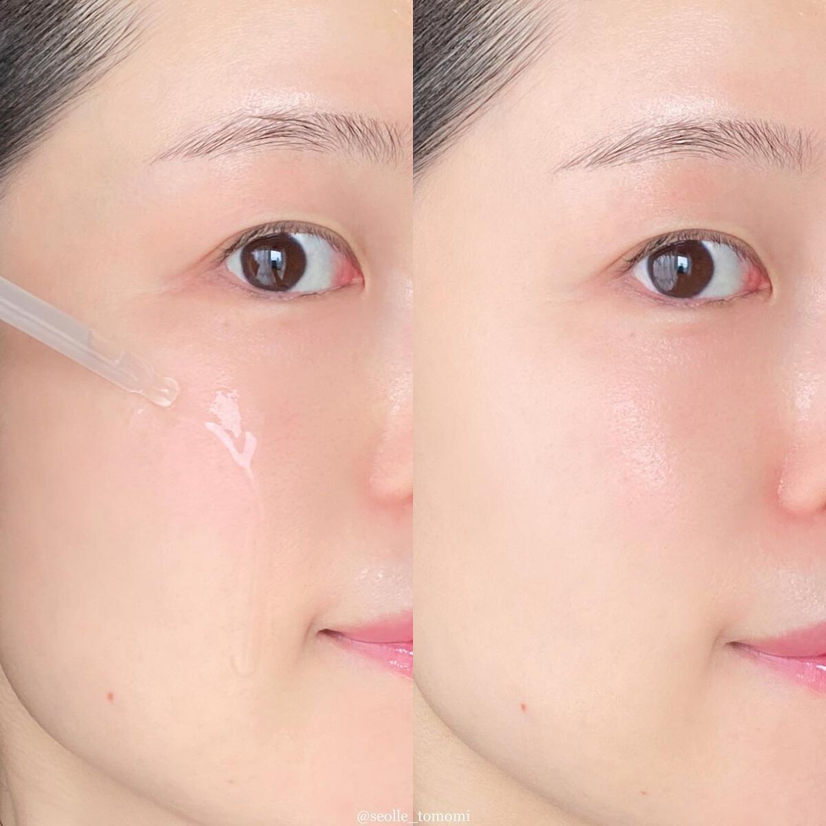 バクチオールAステッカートナー/23years old/化粧水を使ったクチコミ(5枚目)