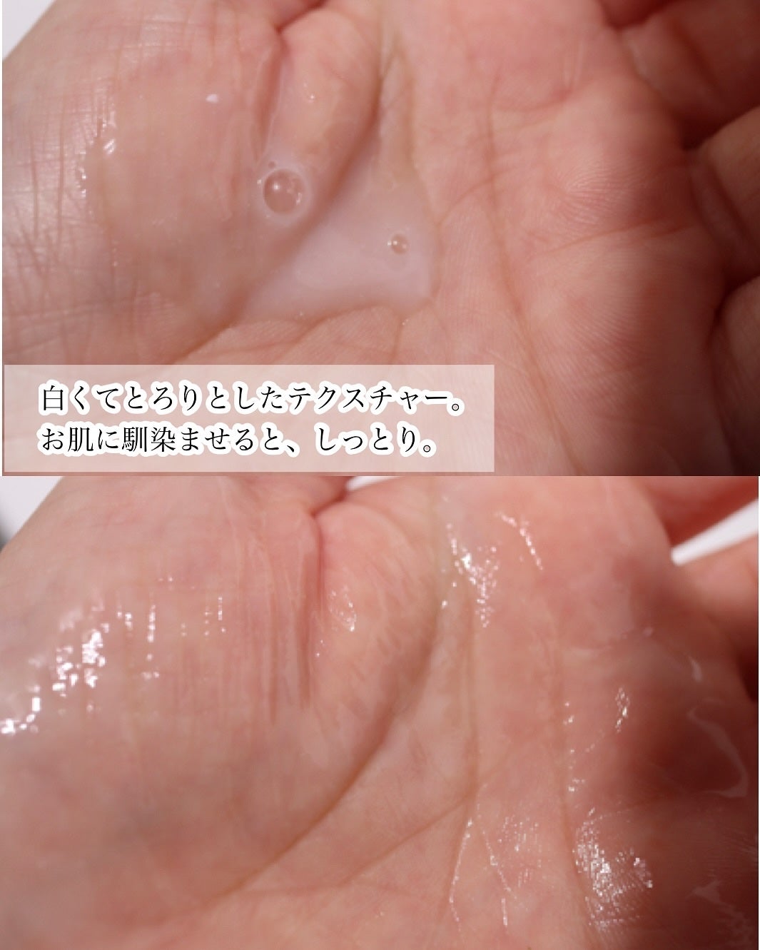 ダーマセラム アゼライン酸5%/SHIMBI METHOD/美容液を使ったクチコミ(3枚目)