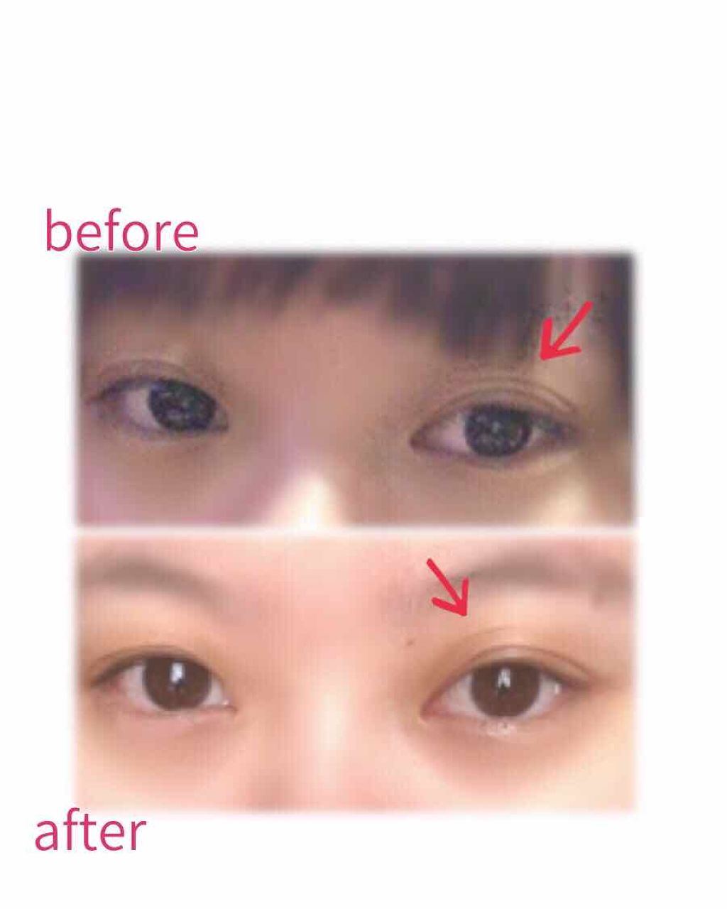 グラン アイ セラム/CLARINS/アイケア・アイクリームを使ったクチコミ(3枚目)