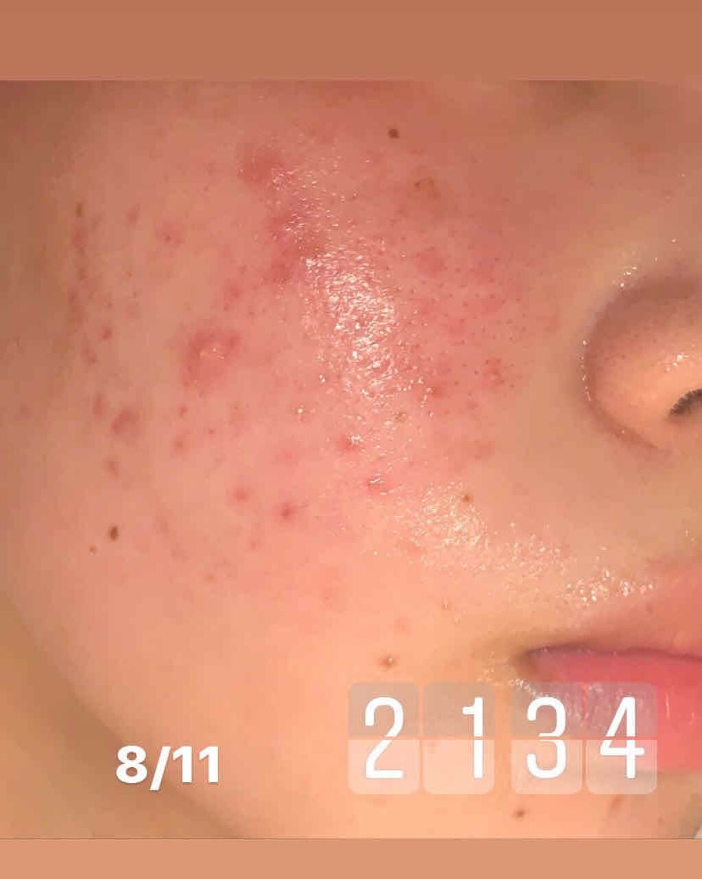 花音 on LIPS 「8月12日5時半起床6時洗顔(ビオレスクラブ)↓化粧水(無印敏..」(3枚目)