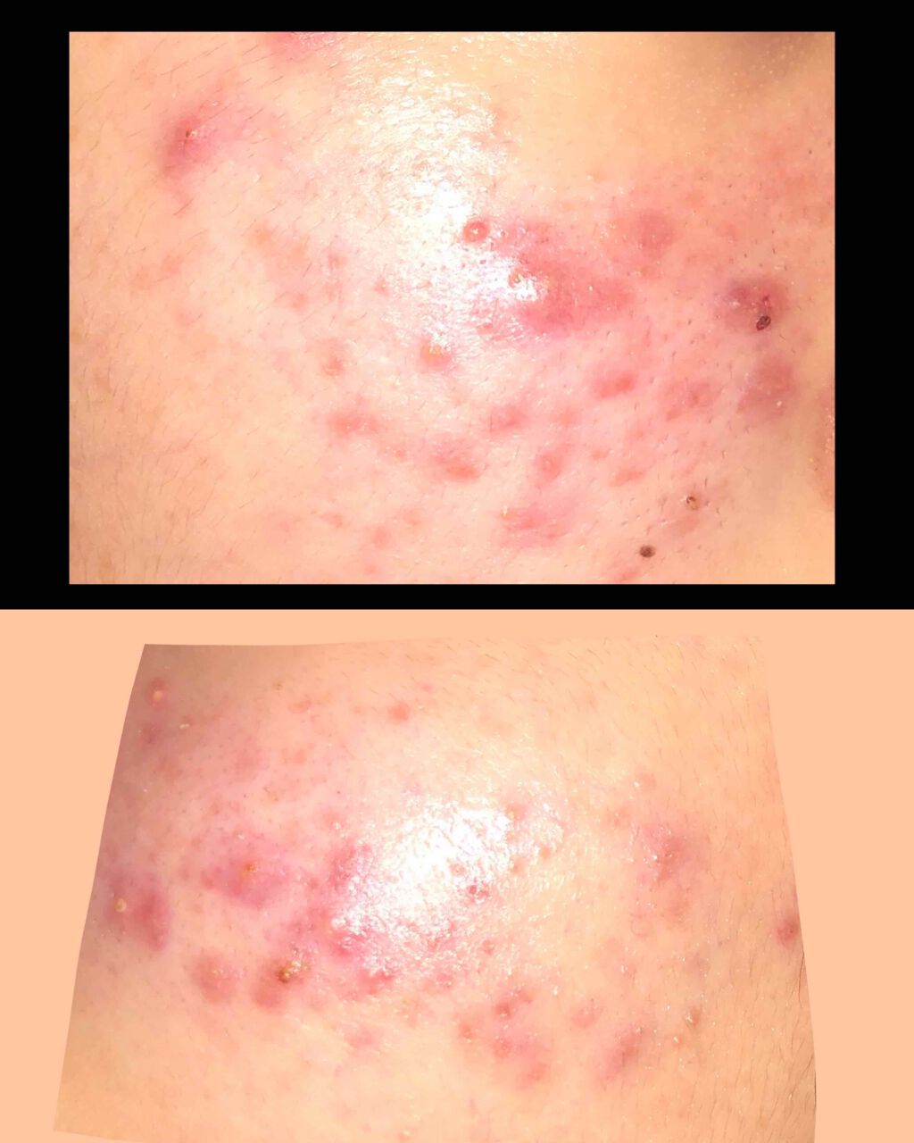 ハトムギ化粧水(ナチュリエ スキンコンディショナー R )/ナチュリエ/化粧水を使ったクチコミ（2枚目）