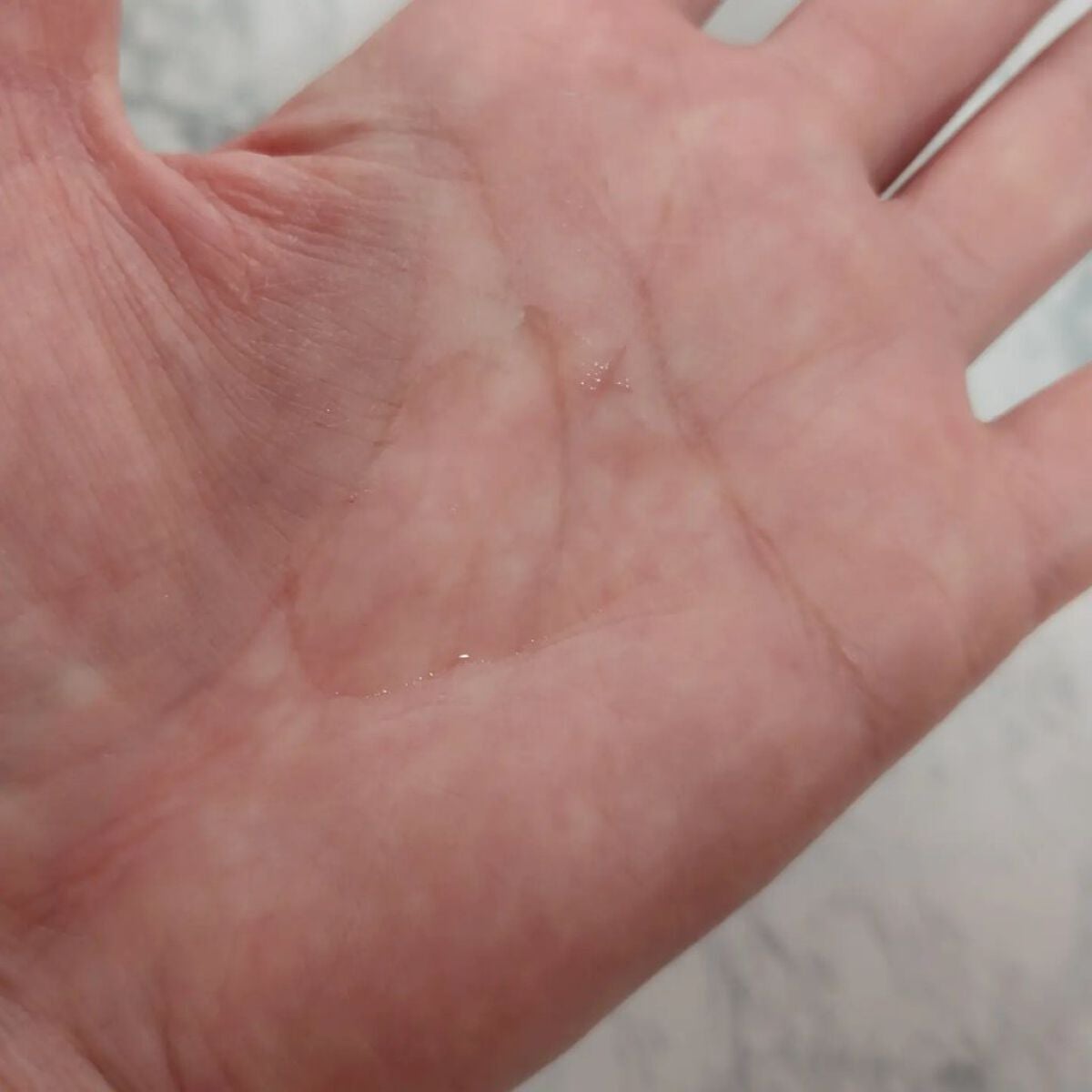 アクレオンセボエクストラクター/ANACIS/その他スキンケアを使ったクチコミ(3枚目)