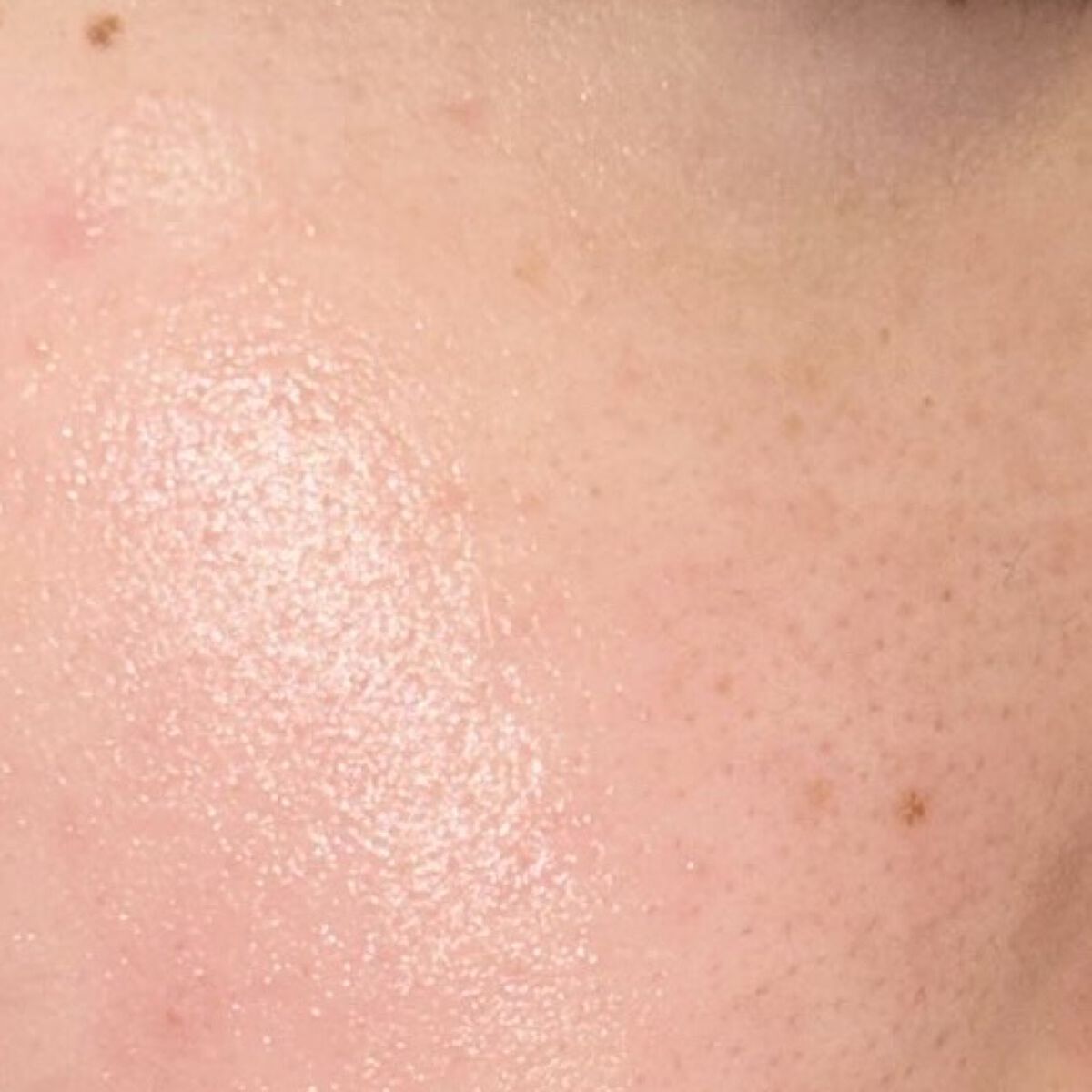 ドクダミ 77 スージングトナー/Anua/化粧水を使ったクチコミ（2枚目）