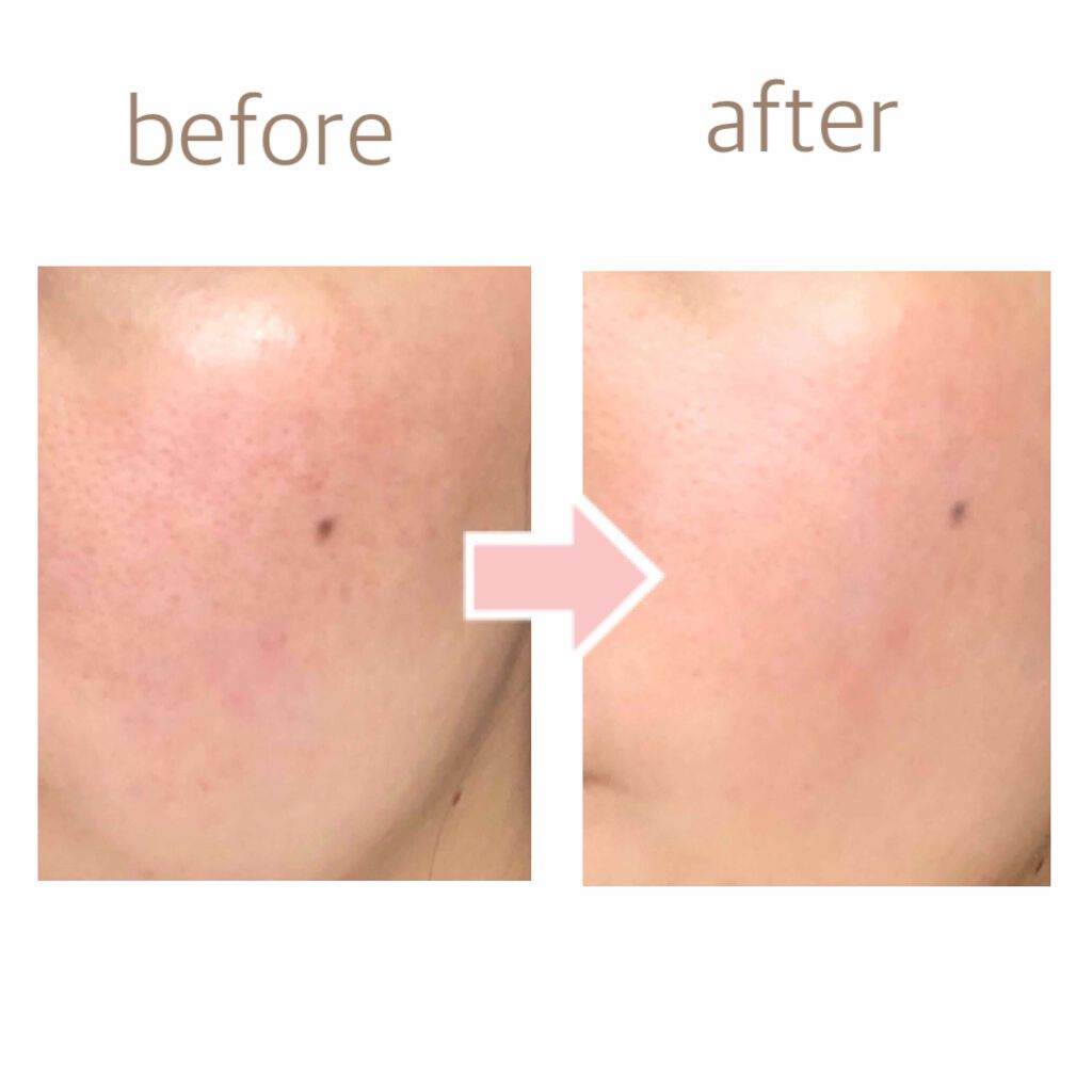 UVミルク/＆be/日焼け止め・UVケアを使ったクチコミ（3枚目）