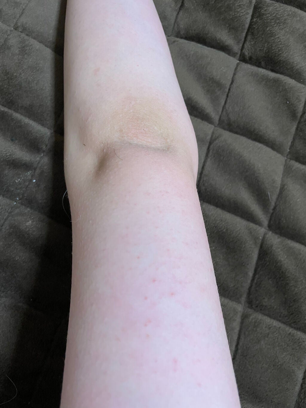 たこまる on LIPS 「経過報告!2枚目3枚目が使う前4枚目5枚目が今日です。使う前の..」(4枚目)