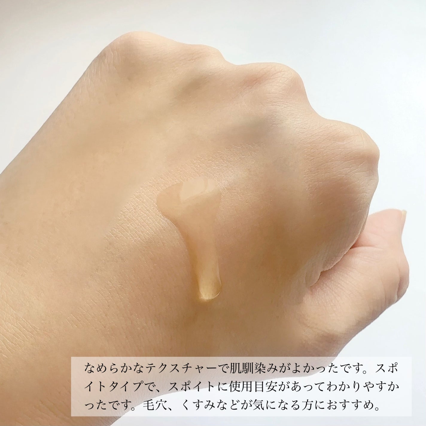 タカミ エッセンス5C+E/タカミ/美容液を使ったクチコミ(3枚目)