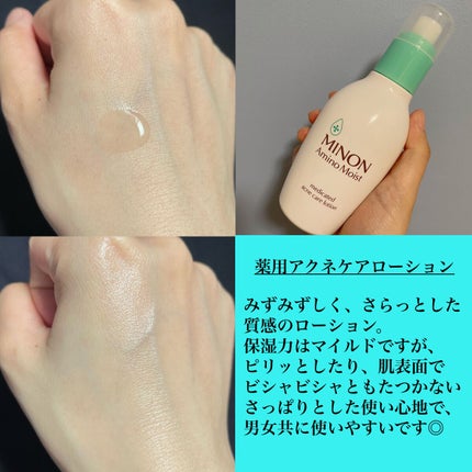 ミノン アミノモイスト 薬用アクネケア ローション/ミノン/化粧水を使ったクチコミ(2枚目)