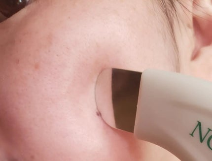 NOPO. ポアクリーンピーラー/コジット/その他スキンケアグッズを使ったクチコミ(5枚目)