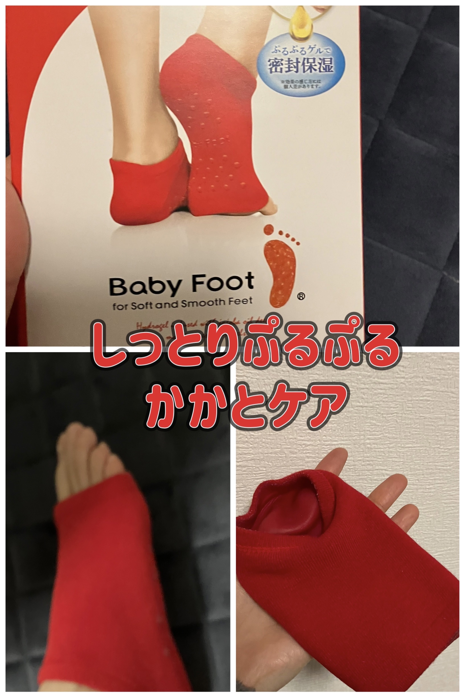 ベビーフット 保湿密封ソックス/ベビーフット/レッグ・フットケアを使ったクチコミ（1枚目）